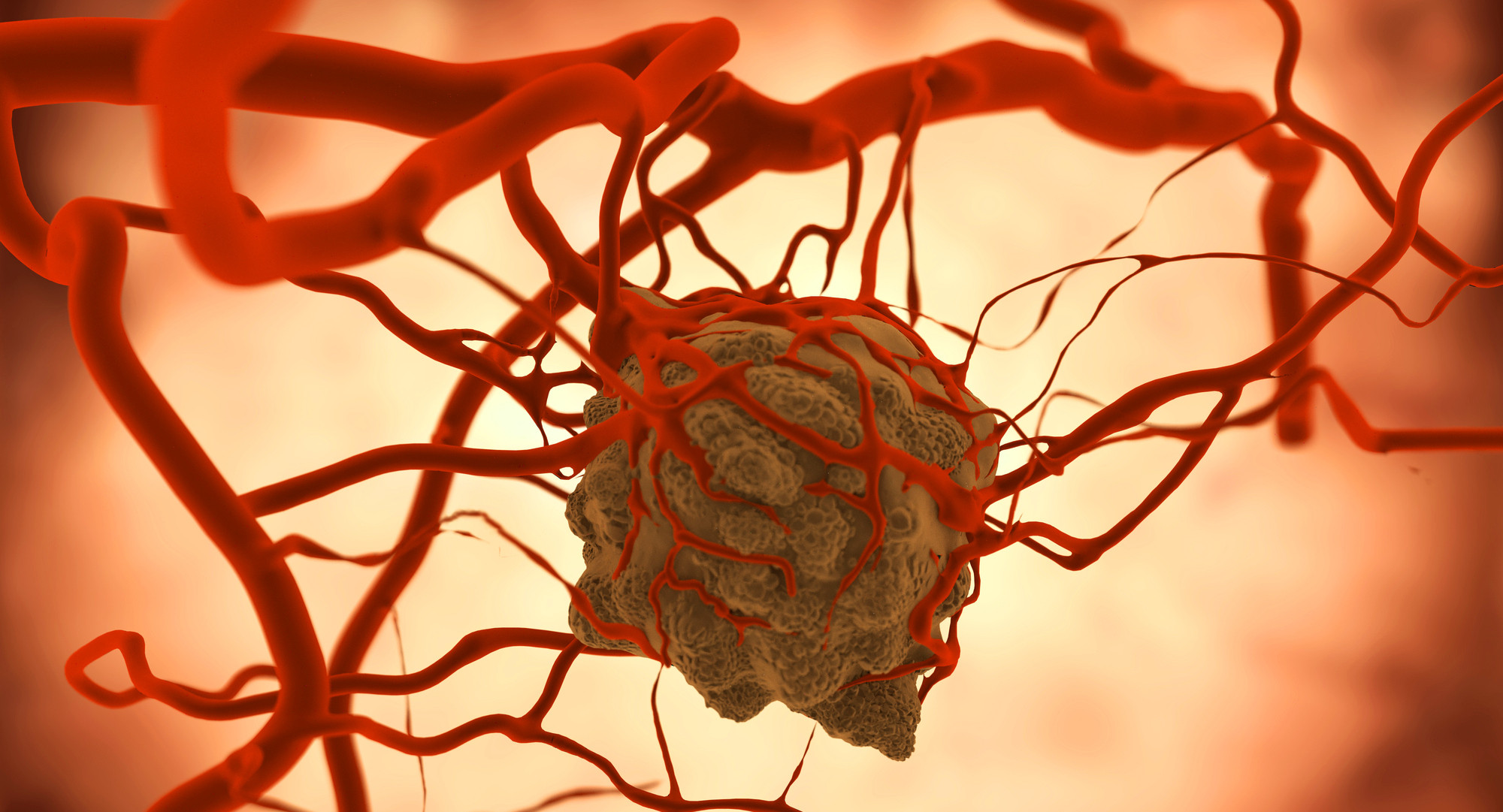 Росстат сообщил о рекордном числе больных раком детей