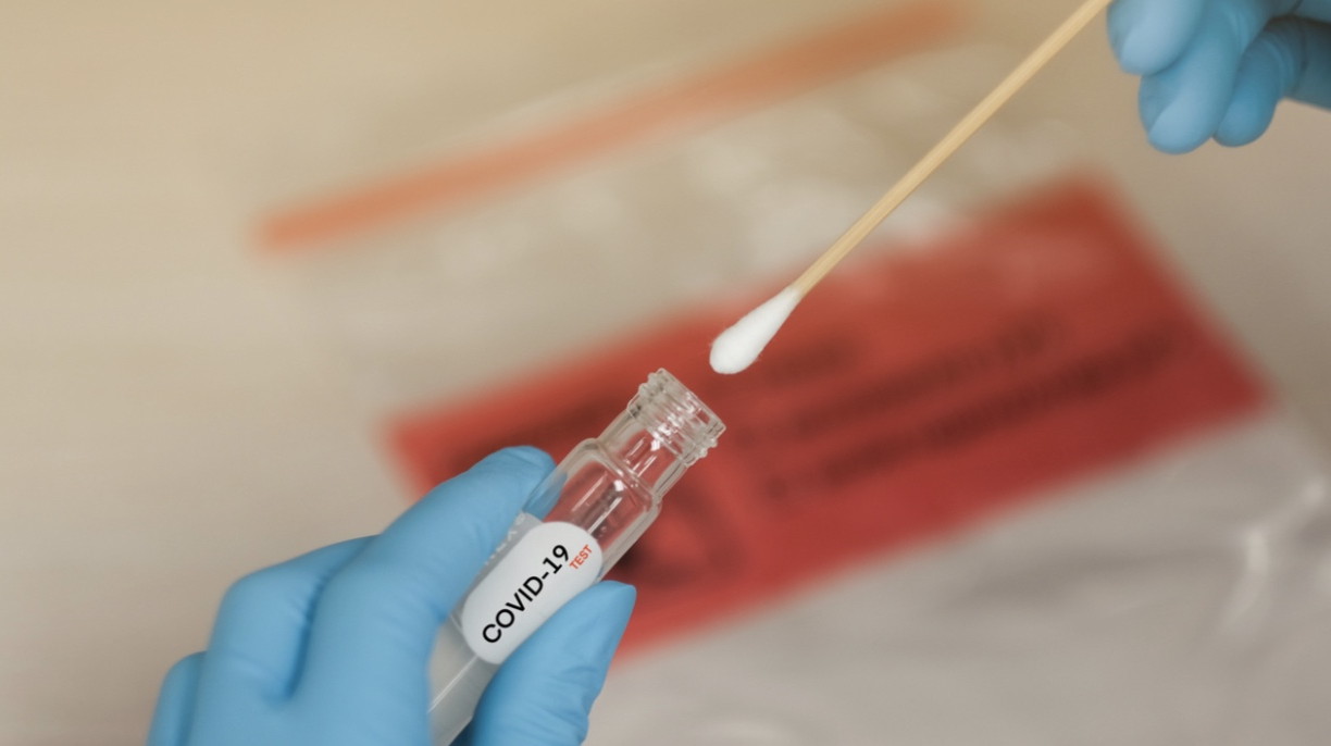 Власти Москвы объявили о начале массового тестирования на антитела к коронавирусу