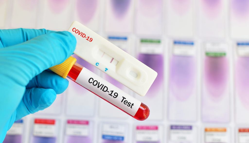 Регионы будут самостоятельно решать, делать ли сдающим ЕГЭ экспресс-тесты на коронавирус