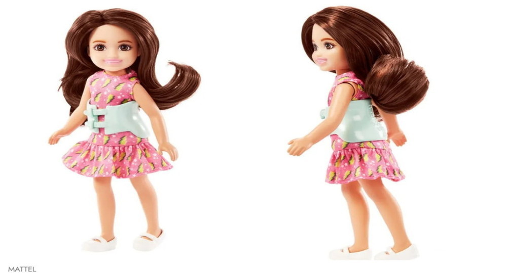 Производитель Barbie выпустит первую куклу со сколиозом
