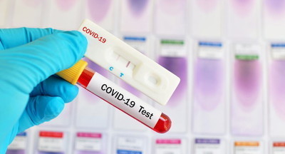 Регионы будут самостоятельно решать, делать ли сдающим ЕГЭ экспресс-тесты на коронавирус