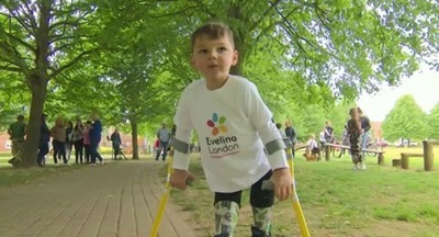 Пятилетний британец, которому ампутировали обе ноги, собрал для спасших его врачей более миллиона фунтов