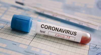 Как педагогам сдать тест на коронавирус и где узнать результат