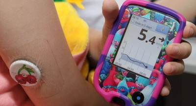 Сергей Собянин поручил обеспечить детей с диабетом системами непрерывного мониторинга глюкозы
